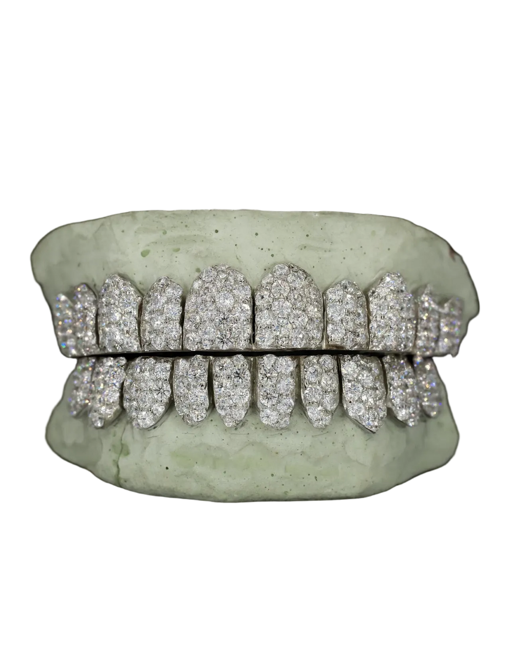 Jumbo Moissanite Grillz