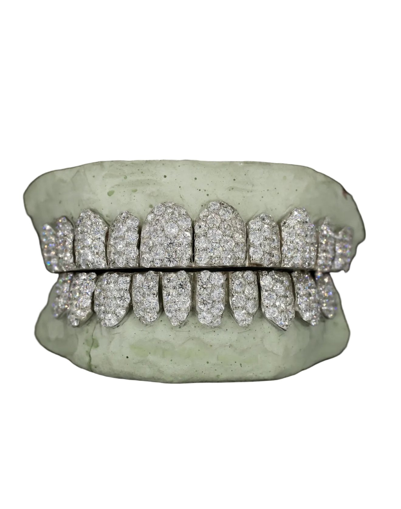 Jumbo Moissanite Grillz