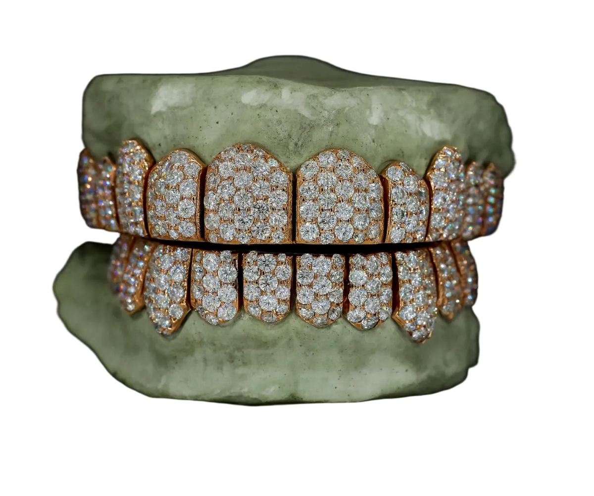 Jumbo Moissanite Grillz