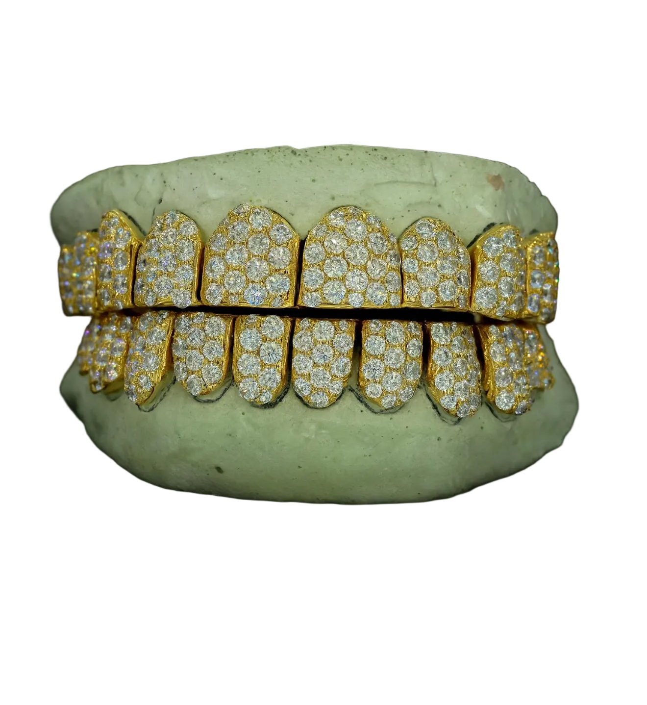 Jumbo Moissanite Grillz