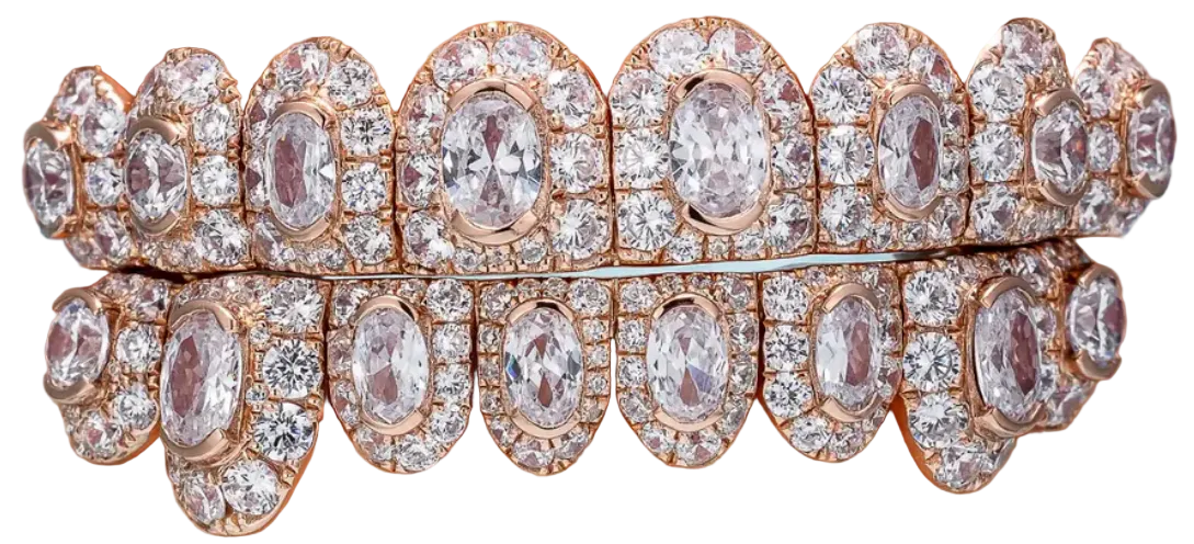 Large Center Stone Moissanite Grillz
