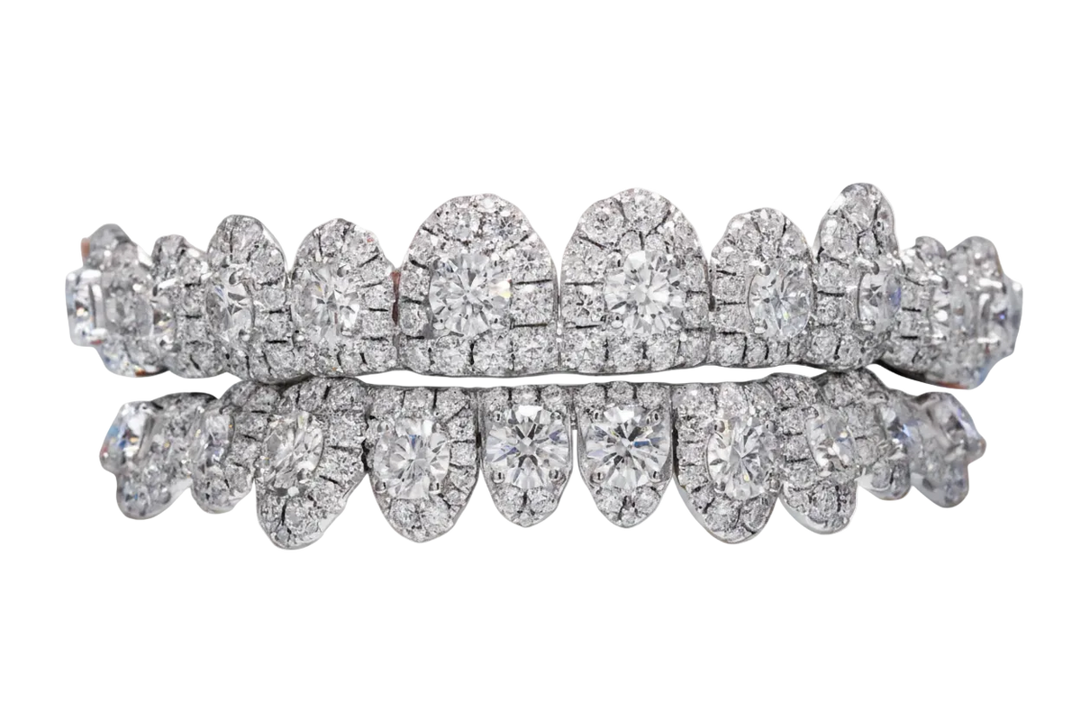 Big Center Stone Moissanite Grillz